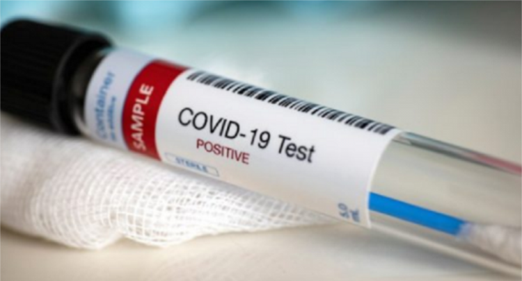 196 raste të reja me COVID-19 dhe 134 të shëruar në 24 orët e fundit